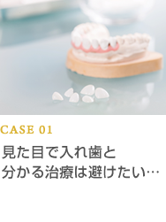 CASE01 見た目で入れ歯と分かる治療は避けたい…