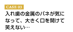 CASE03 入れ歯の金属のバネが気になって、大きく口を開けて笑えない…