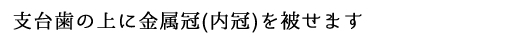 支台歯の上に金属冠(内冠)を被せます