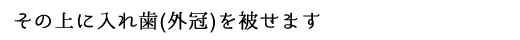 その上に入れ歯(外冠)を被せます