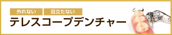 外れない 目立たない テレスコープデンチャー