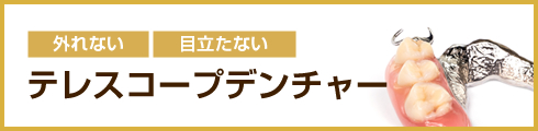 外れない 目立たない テレスコープデンチャー