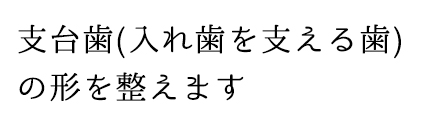 支台歯(入れ歯を支える歯)の形を整えます