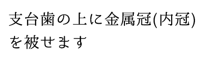 支台歯の上に金属冠(内冠)を被せます